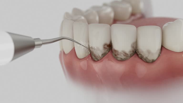 Reliable Dental contractor in Brookdale, CA by Smile Center Dentistry